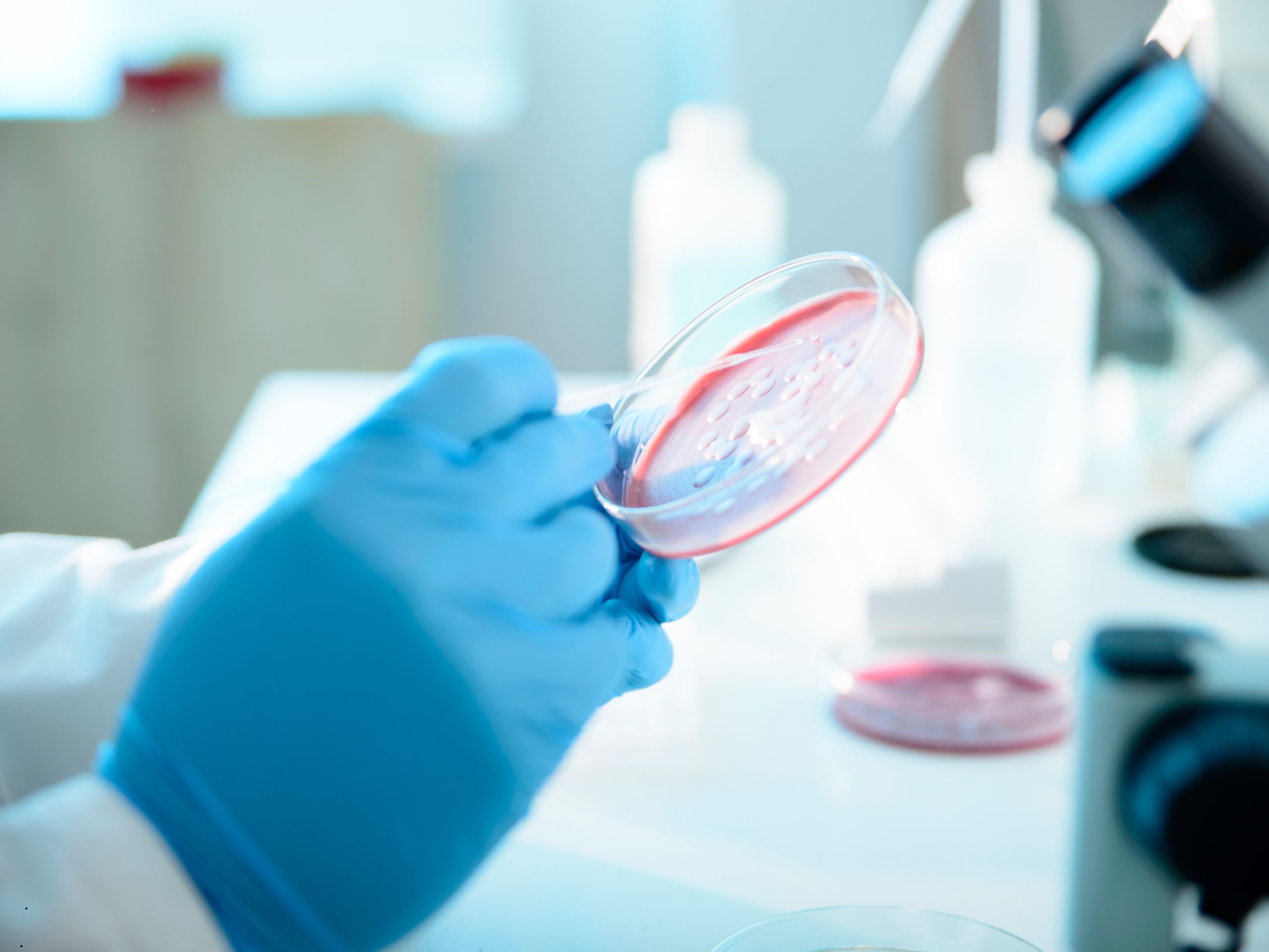 Uso da cultura microbiológica no controle da mastite